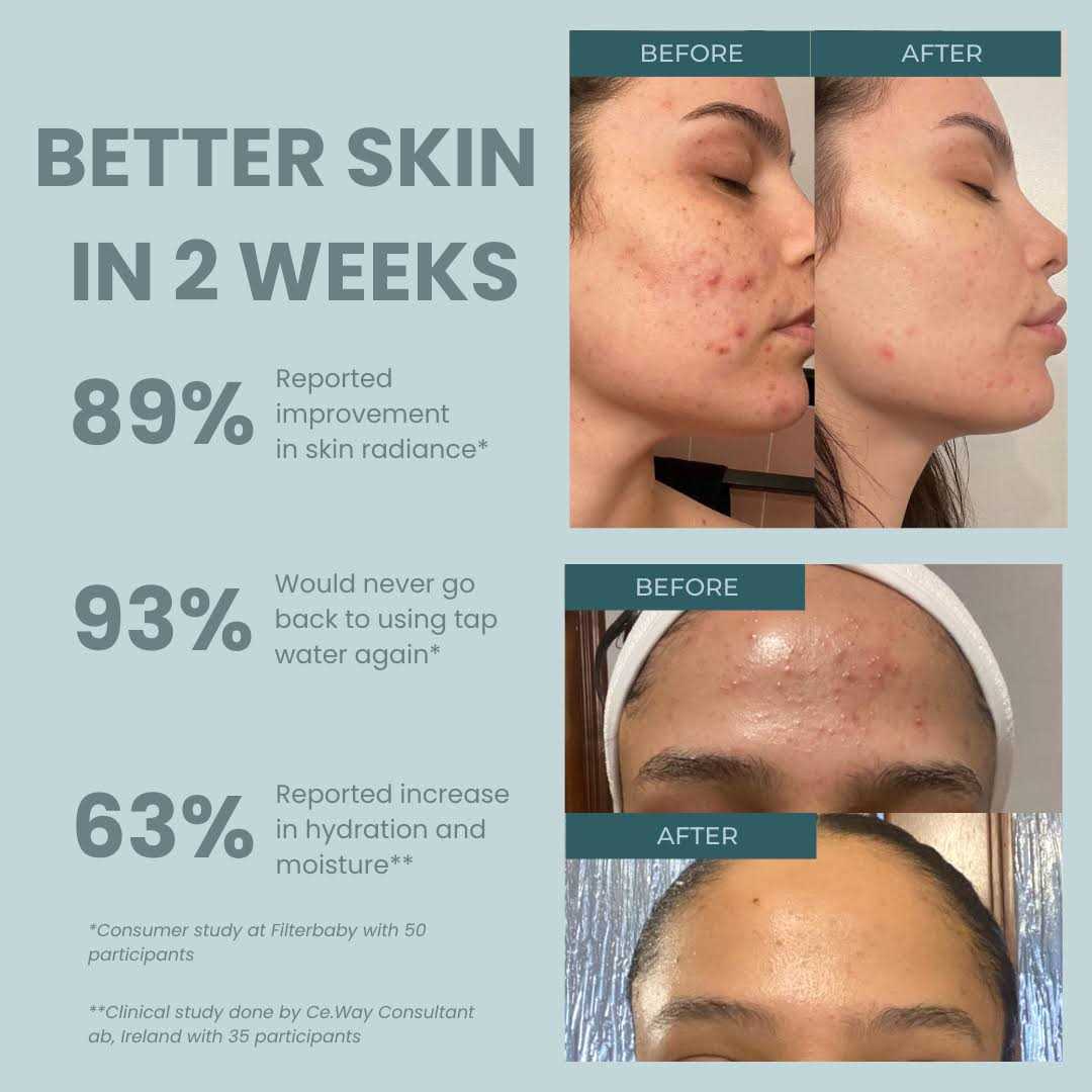 Filter-Monster True HEPA Replacement for GermGuardian Filter C - Inhomebuy